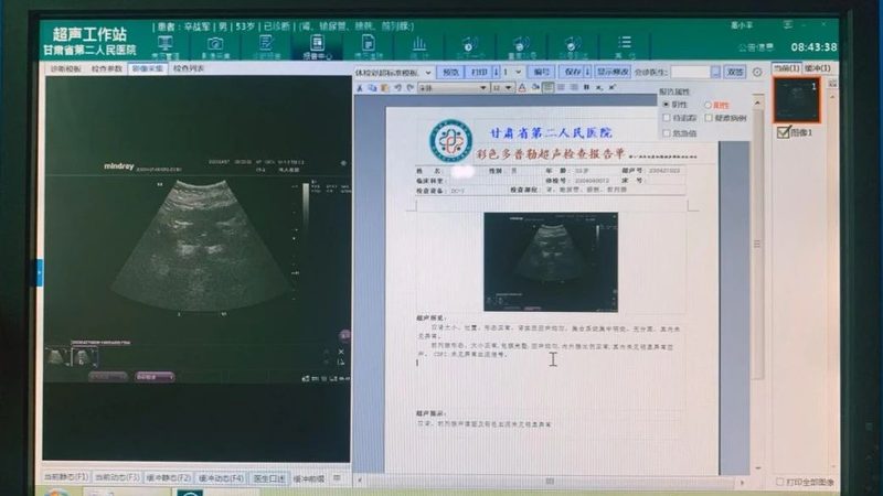 岁女防癌体检，如何选择最佳项目与医院？**